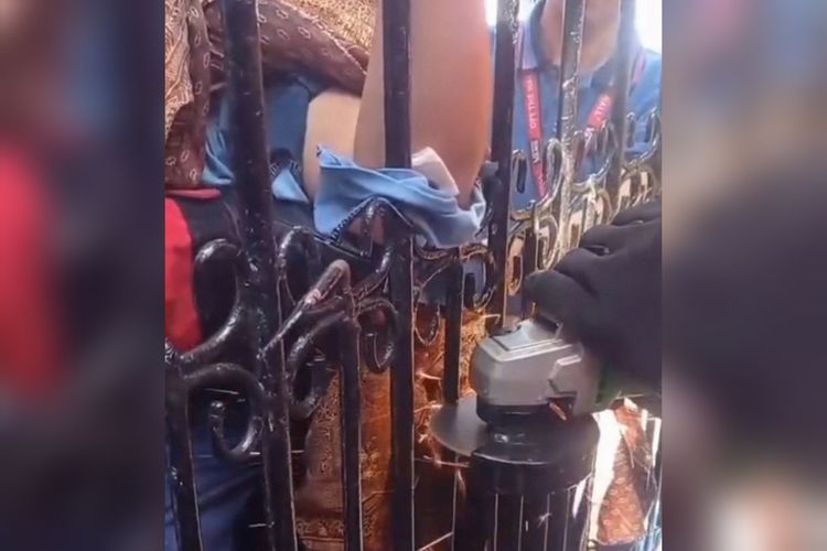 Tangan Bocah SD di Makassar Terjepit Pagar Sekolah, Jalani Operasi Usai Dievakuasi Damkar
